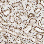 Anti-SUFU Antibody