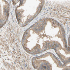 Anti-MRVI1 Antibody