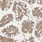 Anti-MRVI1 Antibody