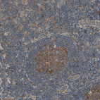 Anti-MRVI1 Antibody