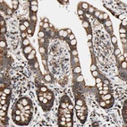 Anti-KIAA0907 Antibody