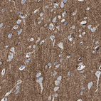 Anti-NFASC Antibody