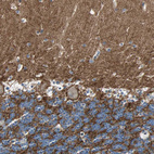 Anti-NFASC Antibody