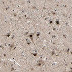 Immunohistochemical staining of human cerebral cortex shows strong nuclear positivity in neuronal cells.