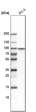 Western blot analysis in human cell line PC-3.