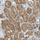 Anti-COTL1 Antibody