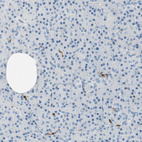 Anti-COTL1 Antibody