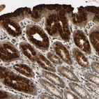 Anti-TMEM230 Antibody