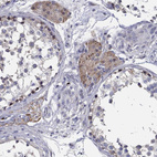 Anti-CFAP61 Antibody