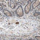 Anti-PNPLA7 Antibody