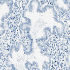 Anti-CDH15 Antibody