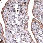 Anti-COL12A1 Antibody