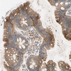 Anti-NDFIP2 Antibody