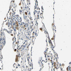 Anti-LDLR Antibody