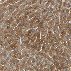 Anti-LDLR Antibody