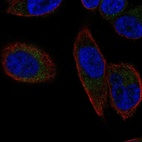 Anti-SLC25A23 Antibody