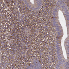 Anti-SFRP4 Antibody