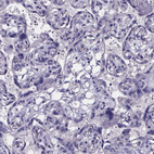 Anti-SFRP4 Antibody