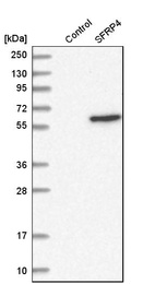 Anti-SFRP4 Antibody