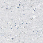 Anti-COL6A3 Antibody