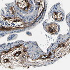 Anti-COL6A3 Antibody