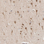 Immunohistochemical staining of human cerebral cortex shows moderate granular cytoplasmic positivity in neurons.