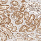 Immunohistochemical staining of human kidney shows moderate granular cytoplasmic positivity in cells in tubules.