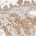 Immunohistochemical staining of human prostate shows moderate cytoplasmic positivity in smooth muscle cells.