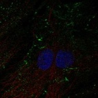 Anti-SHROOM4 Antibody