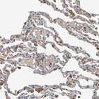 Anti-GAB3 Antibody