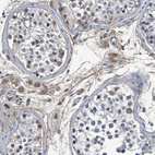 Anti-GAB3 Antibody