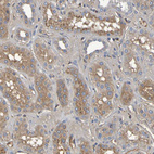 Anti-GAB3 Antibody