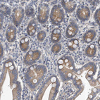 Anti-PCDH8 Antibody