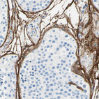 Anti-MFAP5 Antibody