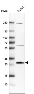 Anti-MFAP5 Antibody