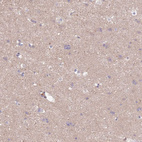 Anti-SYT4 Antibody