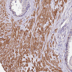 Immunohistochemical staining of human prostate shows moderate cytoplasmic positivity in smooth muscle cells.