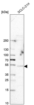 Western blot analysis in human cell line SCLC-21H.