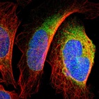 Immunofluorescent staining of human cell line U-2 OS shows localization to endoplasmic reticulum.