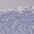 Anti-GLOD5 Antibody