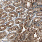 Anti-ETNK1 Antibody