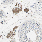 Anti-ETNK1 Antibody