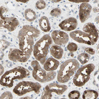 Anti-ETNK1 Antibody