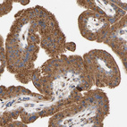 Anti-NECTIN3 Antibody