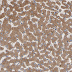 Anti-NECTIN3 Antibody