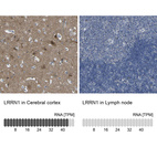 Anti-LRRN1 Antibody