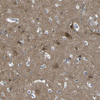 Anti-LRRN1 Antibody