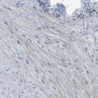 Anti-LRRN1 Antibody