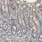 Immunohistochemical staining of human duodenum shows moderate positivity in apical membrane in glandular cells.