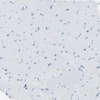 Immunohistochemical staining of human skeletal muscle shows no positivity in myocytes as expected.